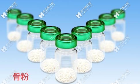 覺得種植牙填進(jìn)口Bioss骨粉價(jià)格貴的人建議看看與國產(chǎn)的區(qū)別