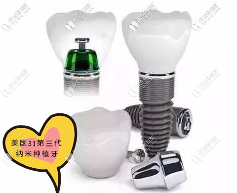 美國(guó)3I納米種植牙多少錢一顆