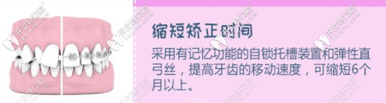 gac半隱形陶瓷自鎖托槽與金屬的區(qū)別是啥
