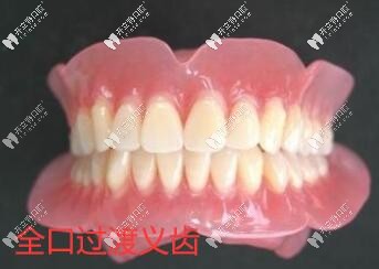 全口義齒