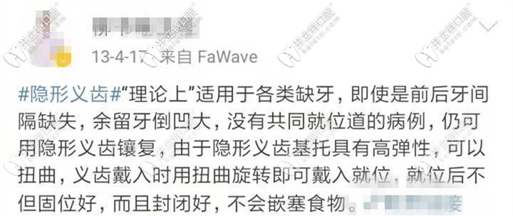 活動隱形義齒的優(yōu)勢