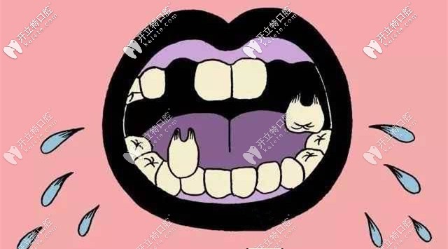 你沒看錯，我就是缺牙了！