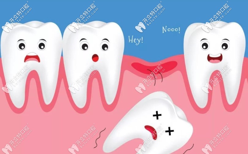 齦下刮治不后悔
