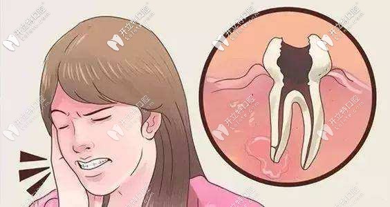 牙疼起來真要命呀