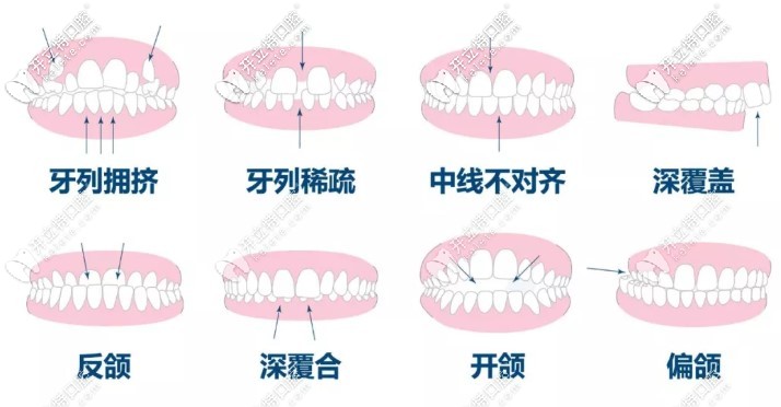 常見的牙齒問題