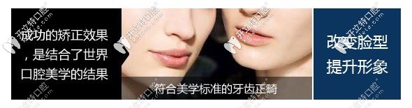 標準的牙齒矯正方式