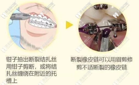 鋼絲滑出的處理方法