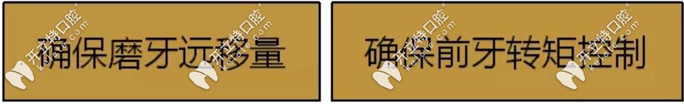 隱適美磨牙后推設(shè)計要點