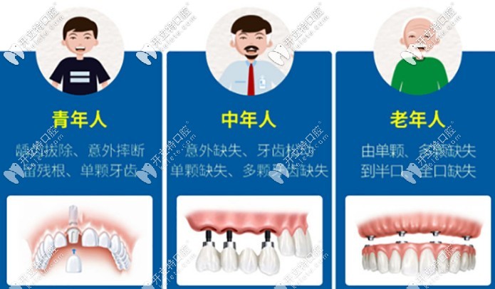 百康特種植體的價格是多少