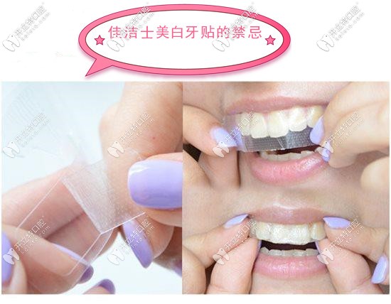 佳潔士美白牙貼的禁忌
