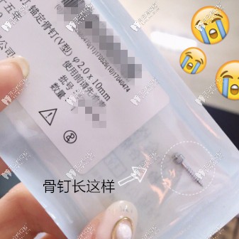 剛拿到骨釘?shù)膱D片