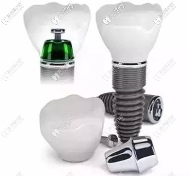 種牙選好植體是關(guān)鍵，醫(yī)生技術(shù)更關(guān)鍵