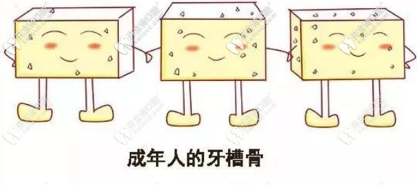 成人牙齒矯正效果不打折