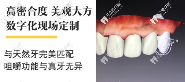 澤康、威蘭德、吉爾巴赫全瓷牙該選哪個(gè)牌子