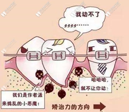 只要牙周健康牙齒矯正都能做