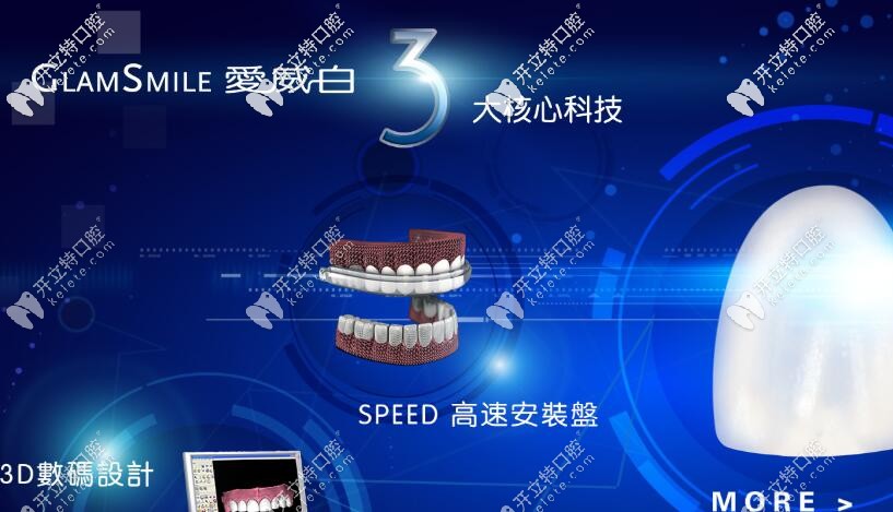 別問多少錢了，先來科普下愛威白牙齒貼面的秘密