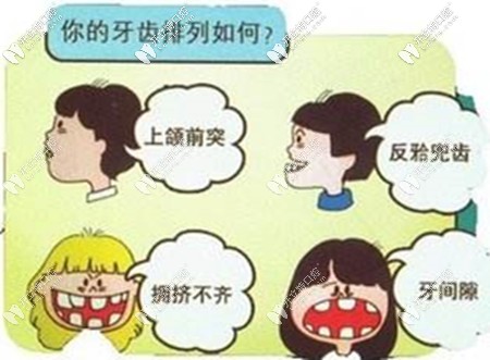 牙齒排列不整齊建議矯正