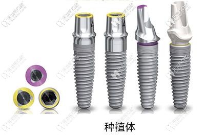 科普不同年齡的人做種牙時,該怎么選擇種植體品牌？