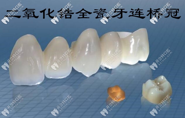 西諾德二氧化鋯全瓷牙可做連橋冠