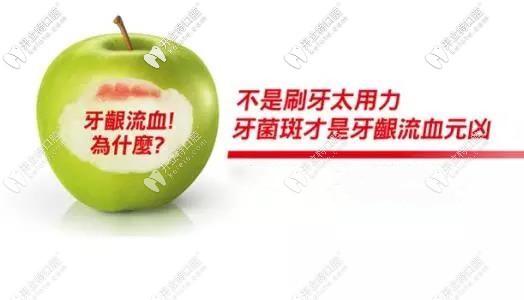 牙菌斑導致牙齦出血