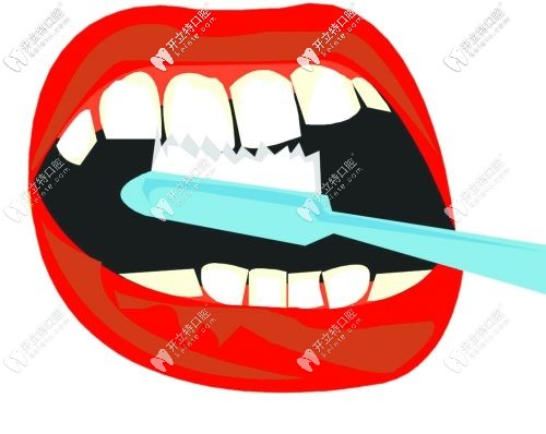 軟毛牙刷進行刷牙