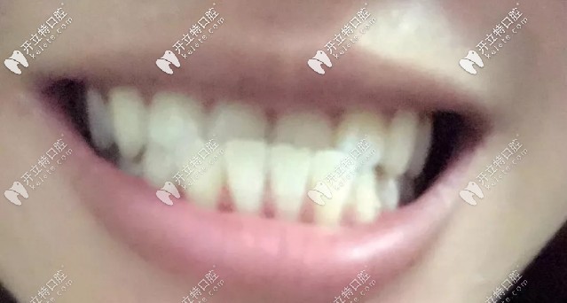 畸形的牙齒各有千秋，整齊的牙齒千篇一律