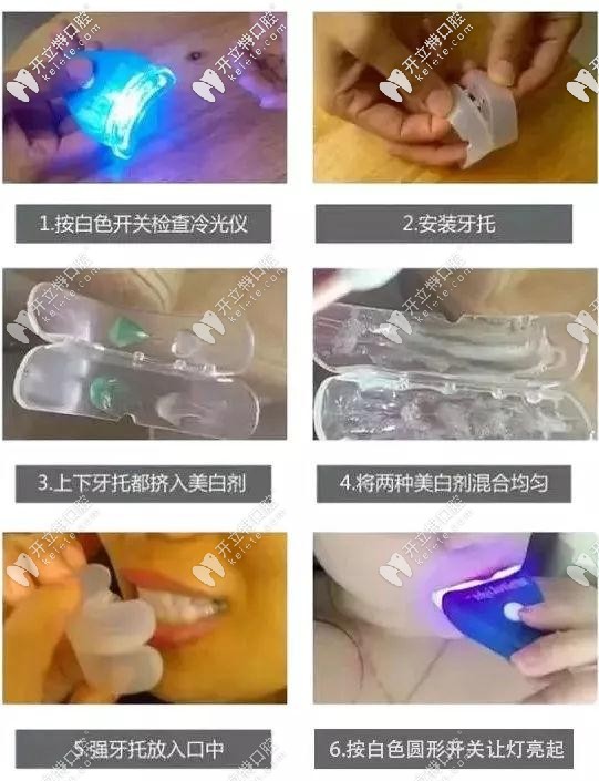 很多美牙儀都是三無(wú)產(chǎn)品