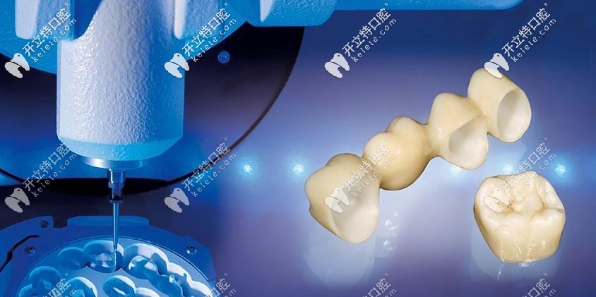 靠譜！德國(guó)威蘭德全瓷牙冠的價(jià)格比之前便宜了將近一半?yún)? border=