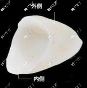 全瓷牙氧化鋁和氧化鋯各有優(yōu)缺點(diǎn),看完區(qū)別再選擇