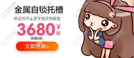 蘭州皓亞口腔金屬托槽矯正優(yōu)惠