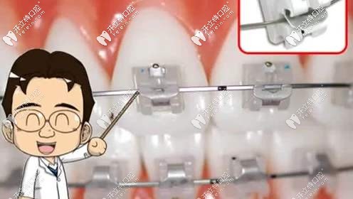 醫(yī)生的技術(shù)決定矯正療效