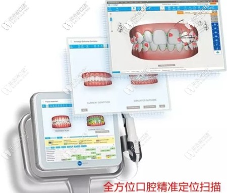 在藝星口腔戴隱形牙套矯正還有優(yōu)惠可享