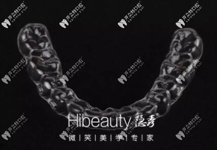 價(jià)格貴≠好,國產(chǎn)牙套隱秀和時(shí)代天使的這些區(qū)別你知道嗎？