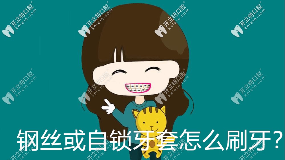 真捉急，剛戴牙套怎么刷牙啊