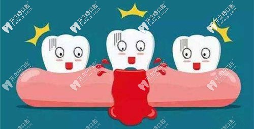 牙齦出血等情況不適合進(jìn)行牙齦按摩