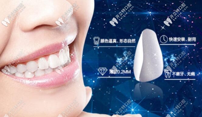 南京藝星口腔牙齒瓷貼面