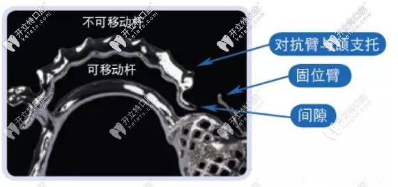 維他靈支架的構(gòu)造
