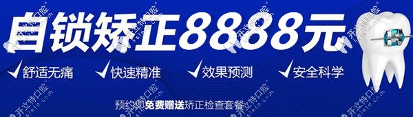 自鎖矯正8888元起