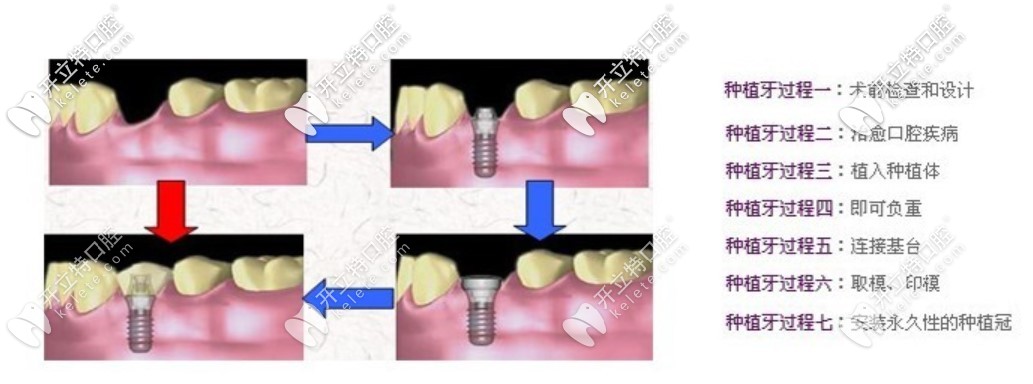林杰醫(yī)生比較擅長的項目