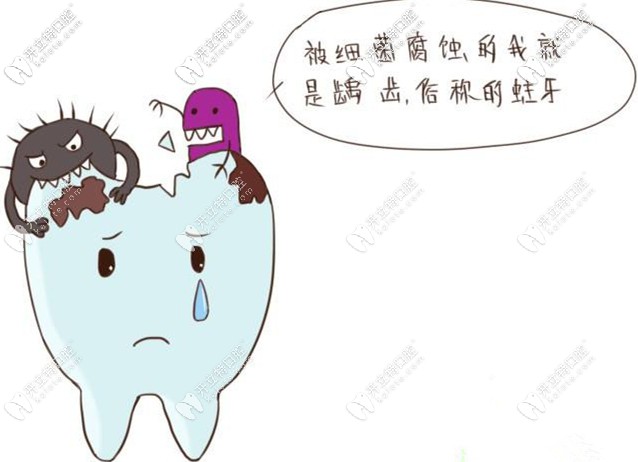 被細(xì)菌輔食就是齲齒俗稱蛀牙