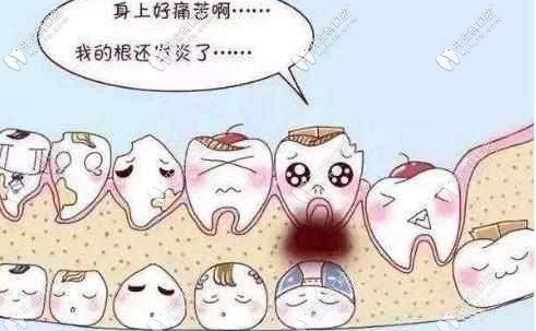 兒童齲齒的常見癥狀以及齲齒是如何產(chǎn)生