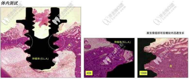 種植體親水性好