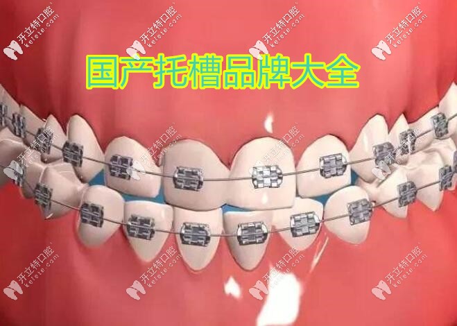 國產(chǎn)托槽品牌大匯總,你知道價格貴的和便宜的區(qū)別在哪里嗎