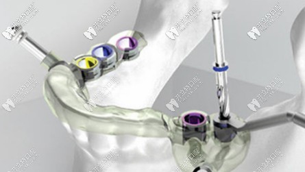 數(shù)字化智慧種植技術(shù)