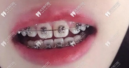 相比之前已經(jīng)排齊了很多