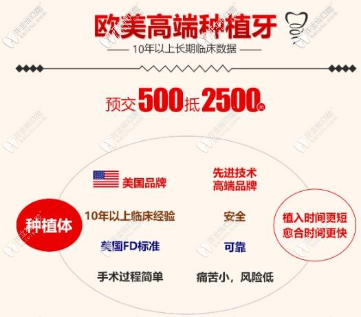 歐美種植體優(yōu)勢