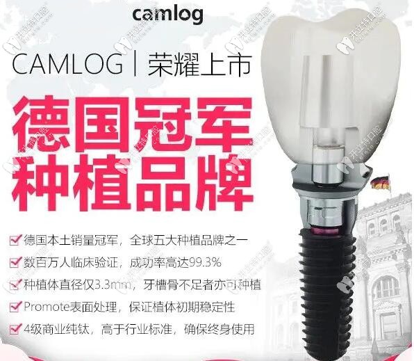 今天才知道了德國camlog種植體的價格，聽說質(zhì)量也不錯