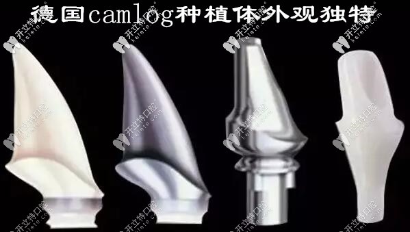 德國camlog種植牙的價格貴嗎