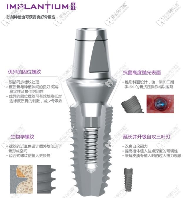 登騰lmplantiumⅡ型號