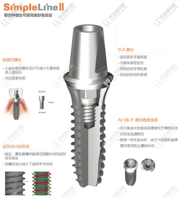 登騰simpleLineⅡ種植體型號